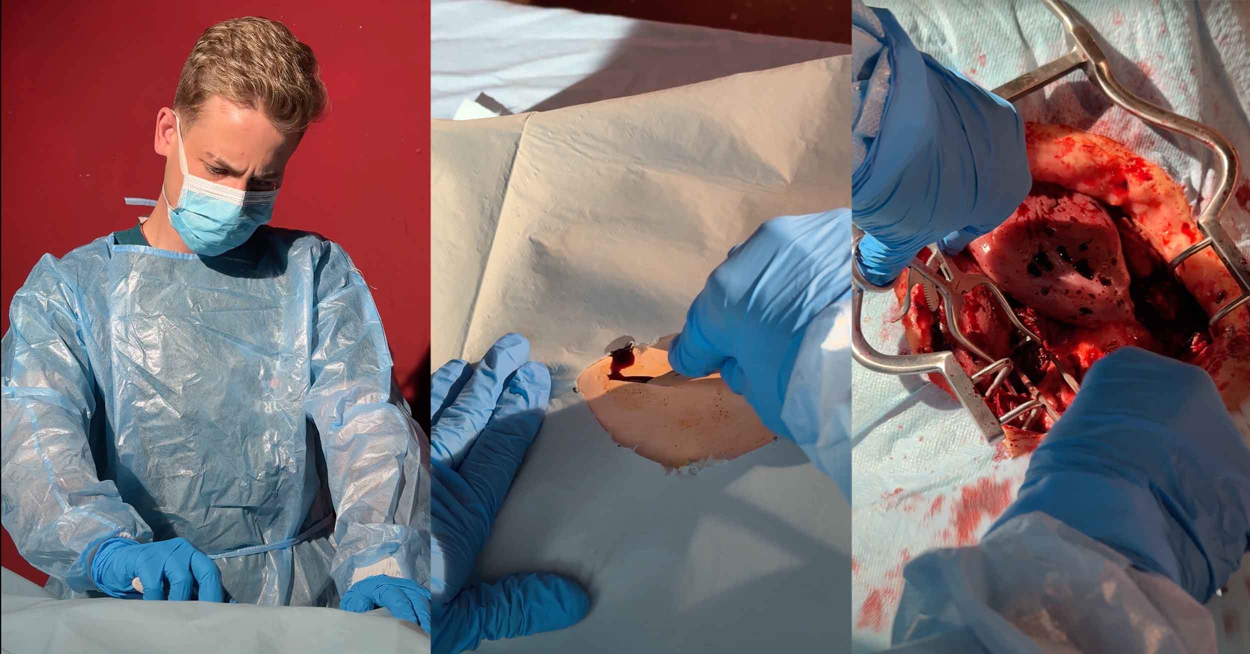 Recreación de cirugía de órganos en el Curso de Caracterización y Efectos de Maquillaje